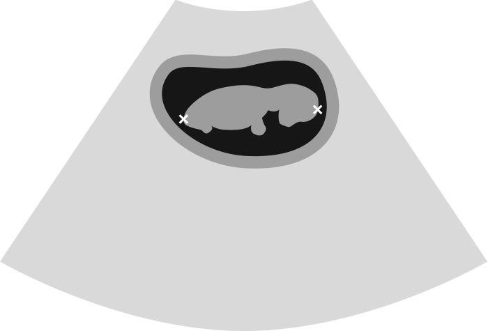 Very Advanced CRL-very-advanced – Animal Ultrasound Association