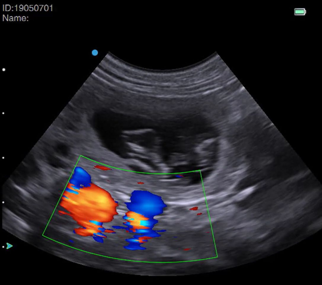 One way to use your Colour Doppler when performing a canine pregnancy scan