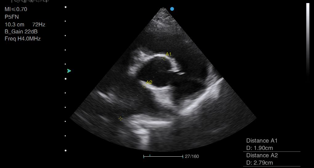 Veterinary Echocardiography Newsletter 7 Cardiac screening Animal