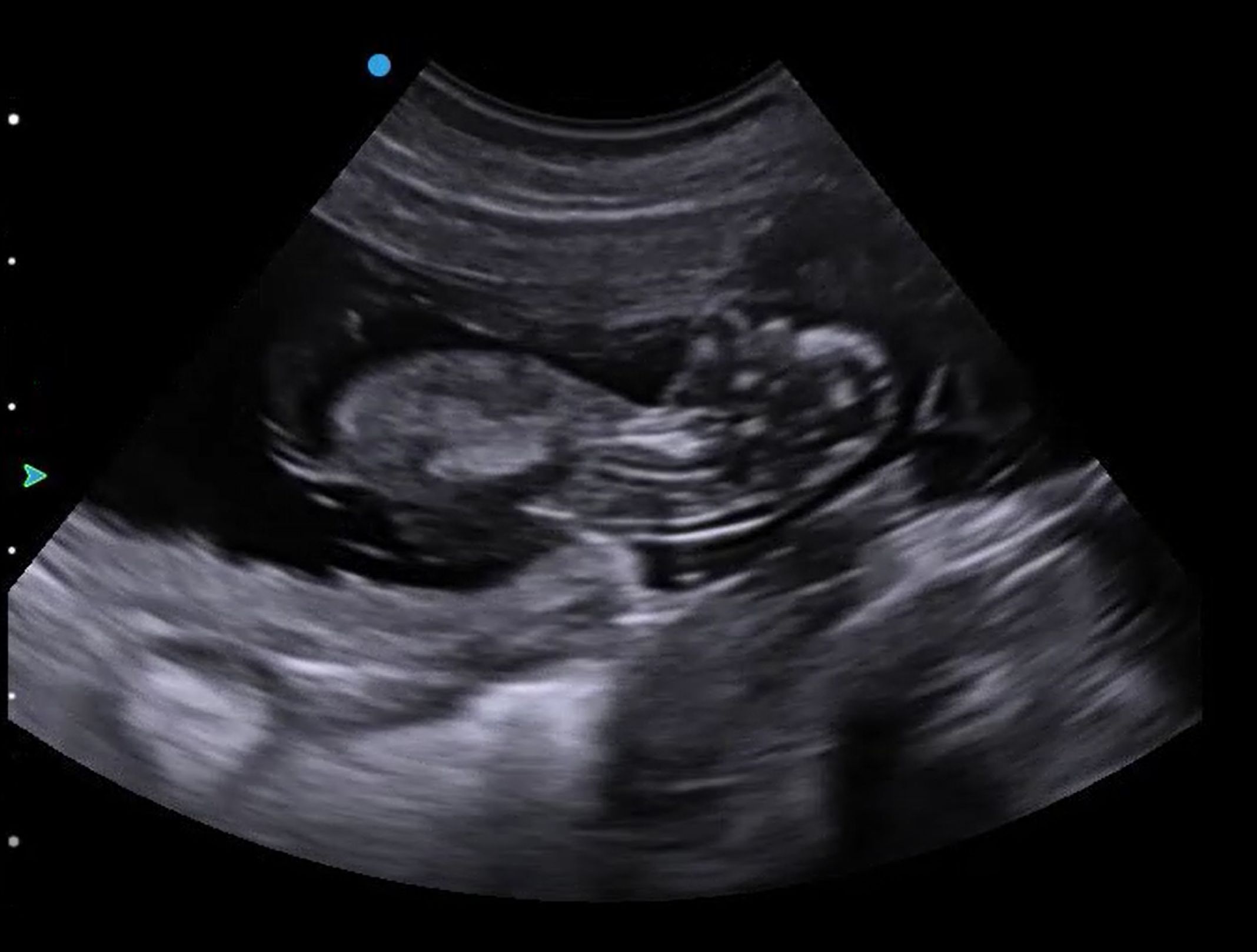 What type of ultrasound training should I undertake?