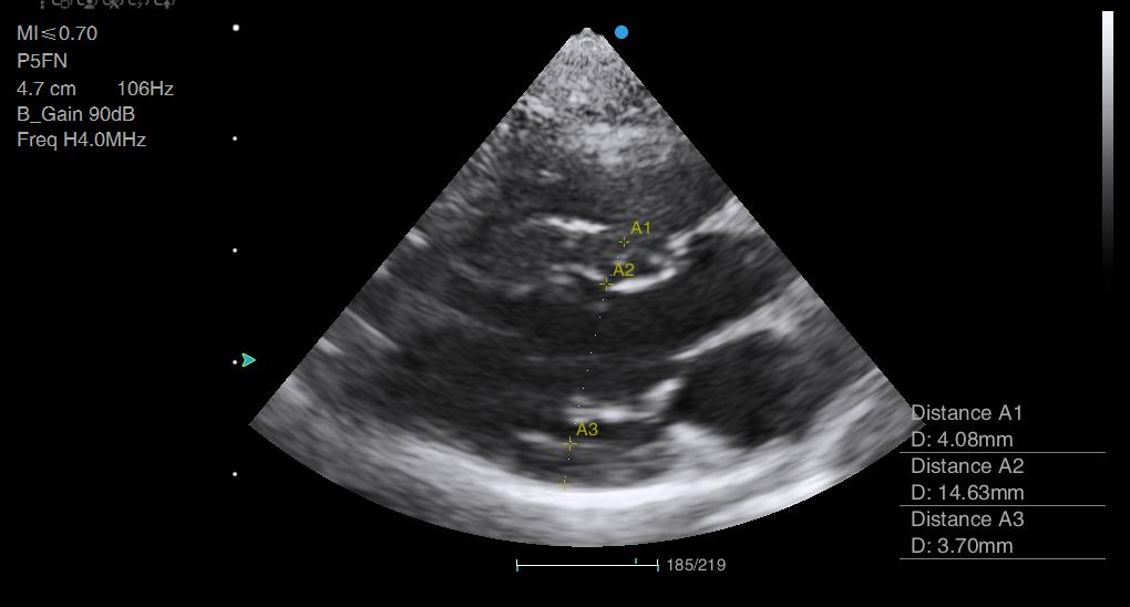 Cat Echocardiography Animal Ultrasound Association