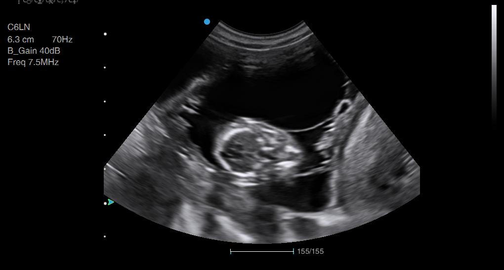 Dachshund Pregnancy Scan Animal Ultrasound Association