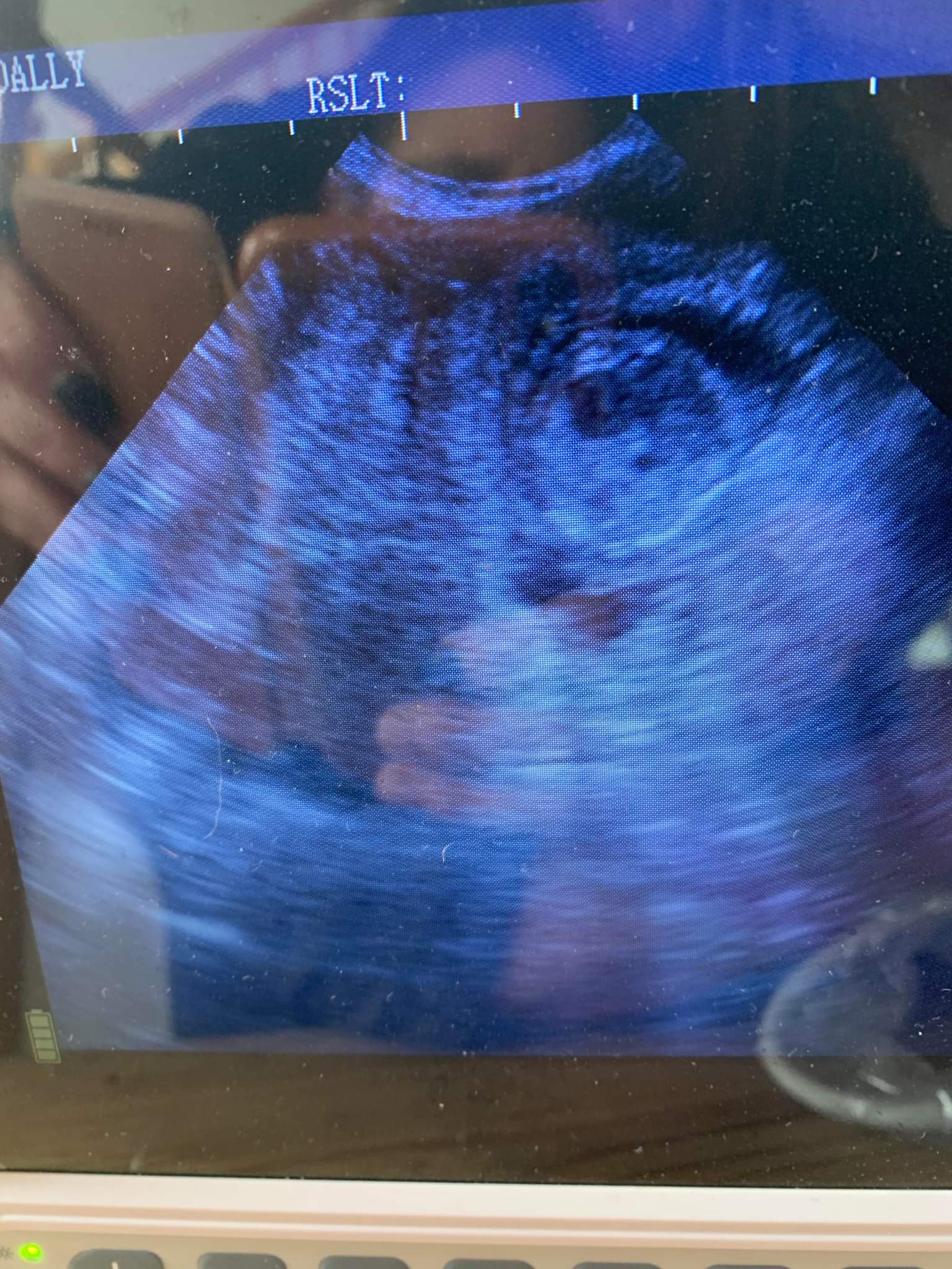 Dachshund progress scan Animal Ultrasound Association