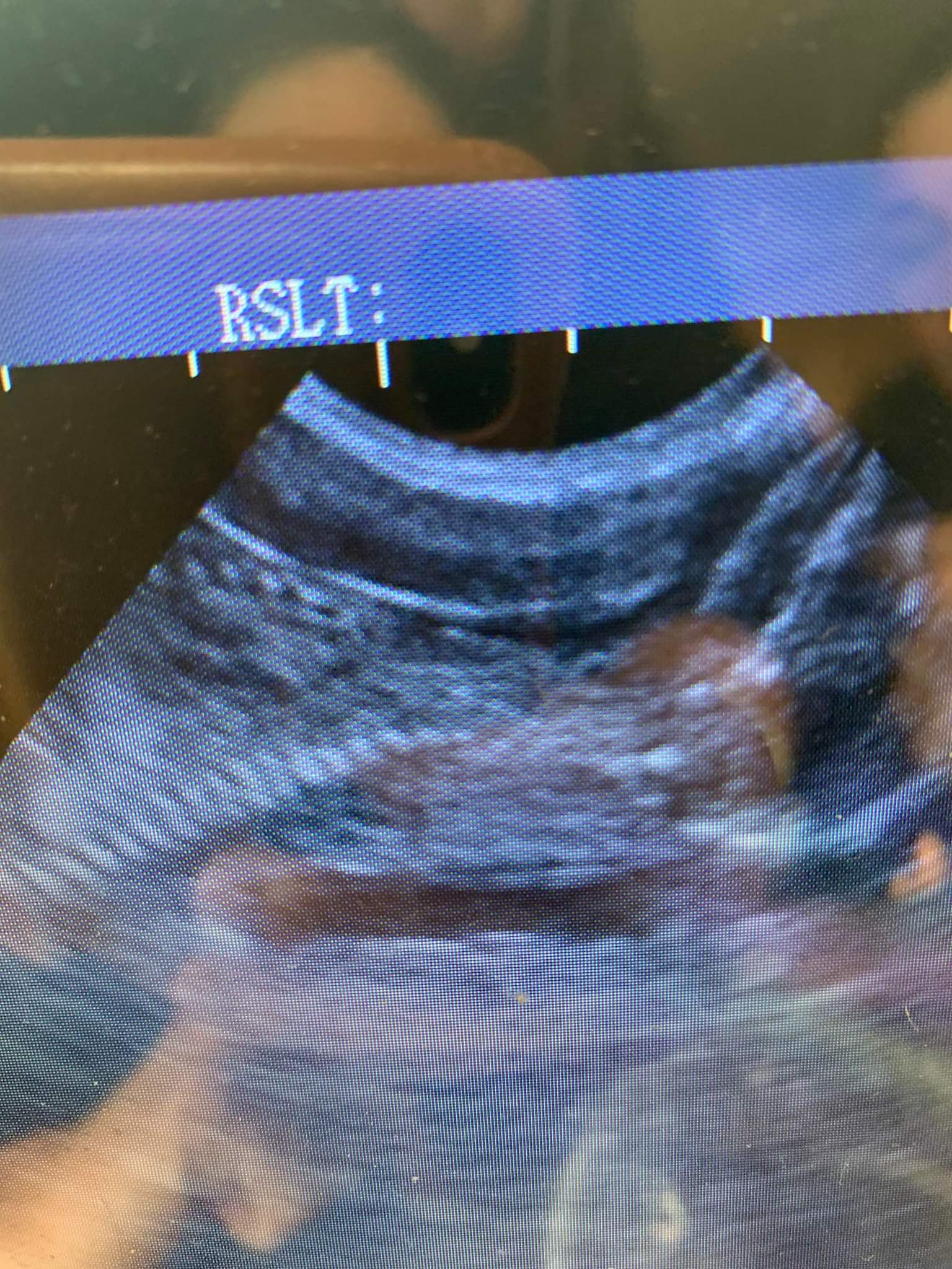 Dachshund progress scan Animal Ultrasound Association