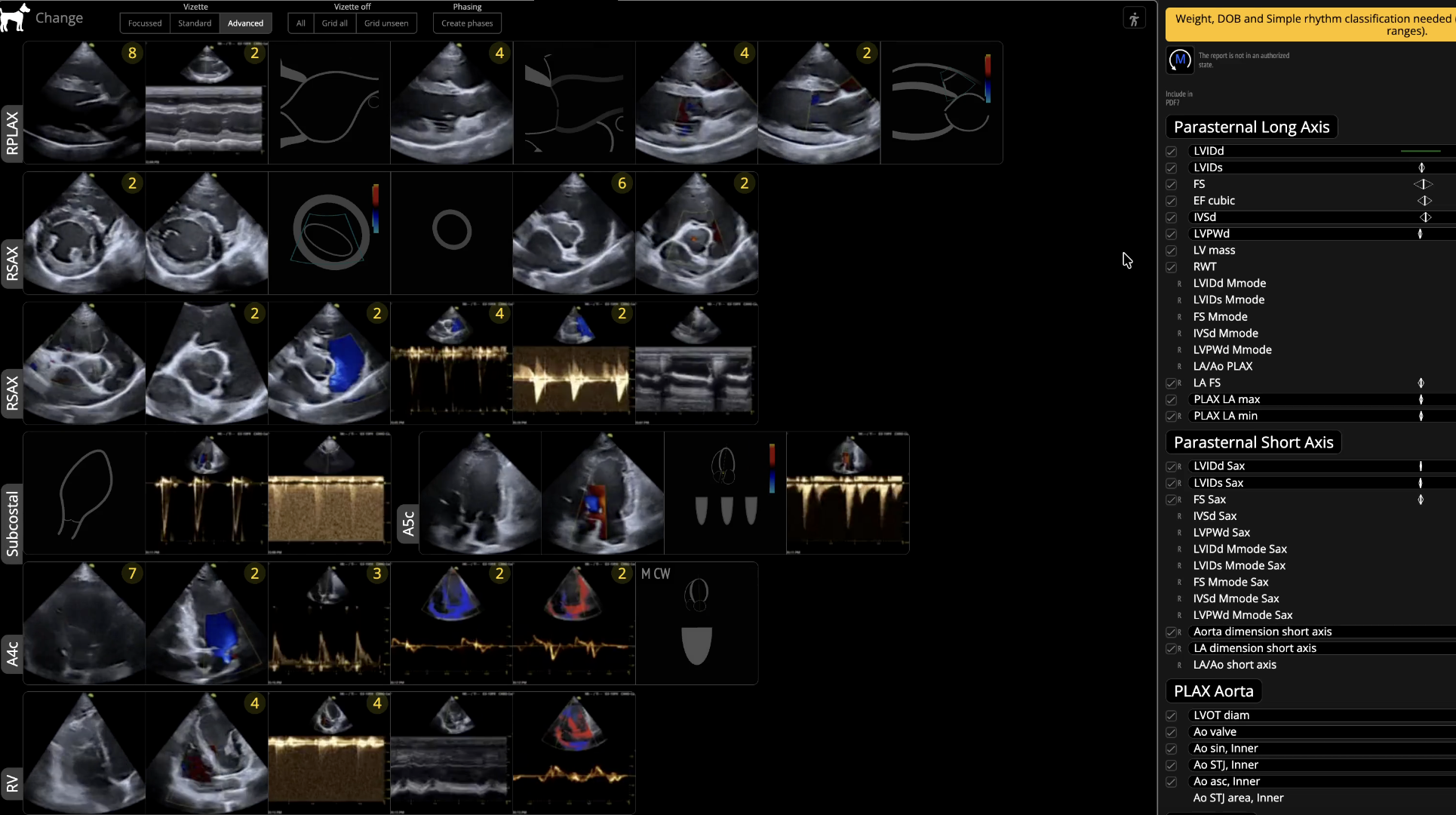 Quantum Veterinary Echocardiography